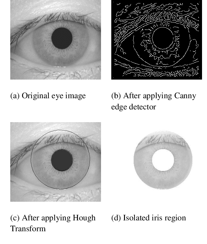Iris Recognition Computer Vision